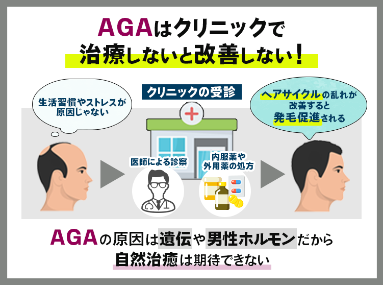 AGA治療のフローチャート