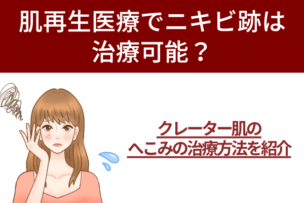 肌再生医療でニキビ跡は治療可能？クレーター肌のへこみの治療方法を紹介